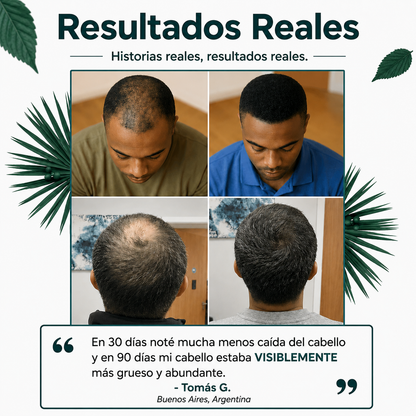 SELF CARE DHT BLOCKER | Menos caída. Más crecimiento. Cabello más fuerte.
